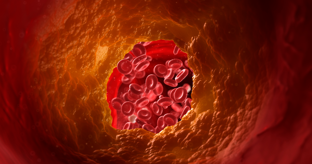 الكوليسترول