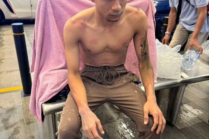 لاعب دولي يتعرض لهجوم بمادة حارقة