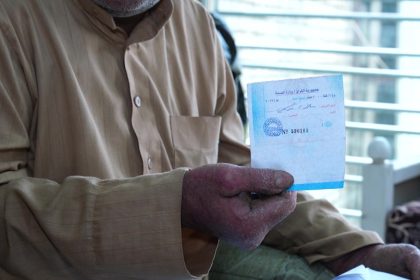 نقص العلاجات وتنمر المجتمع.. واقع مرير يحيط بمصابي الامراض الجلدية