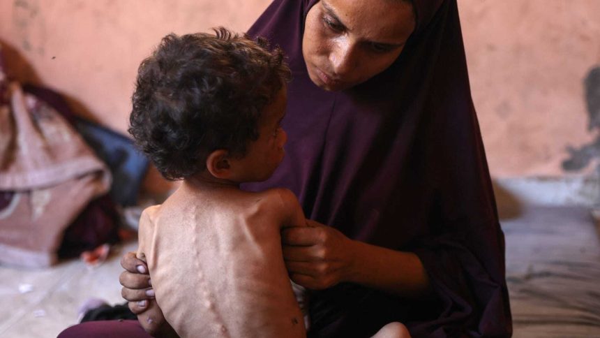 وباء جديد يضرب غزة: فيروس قاتل يشبه كورونا يفتك بالأطفال الجوعى