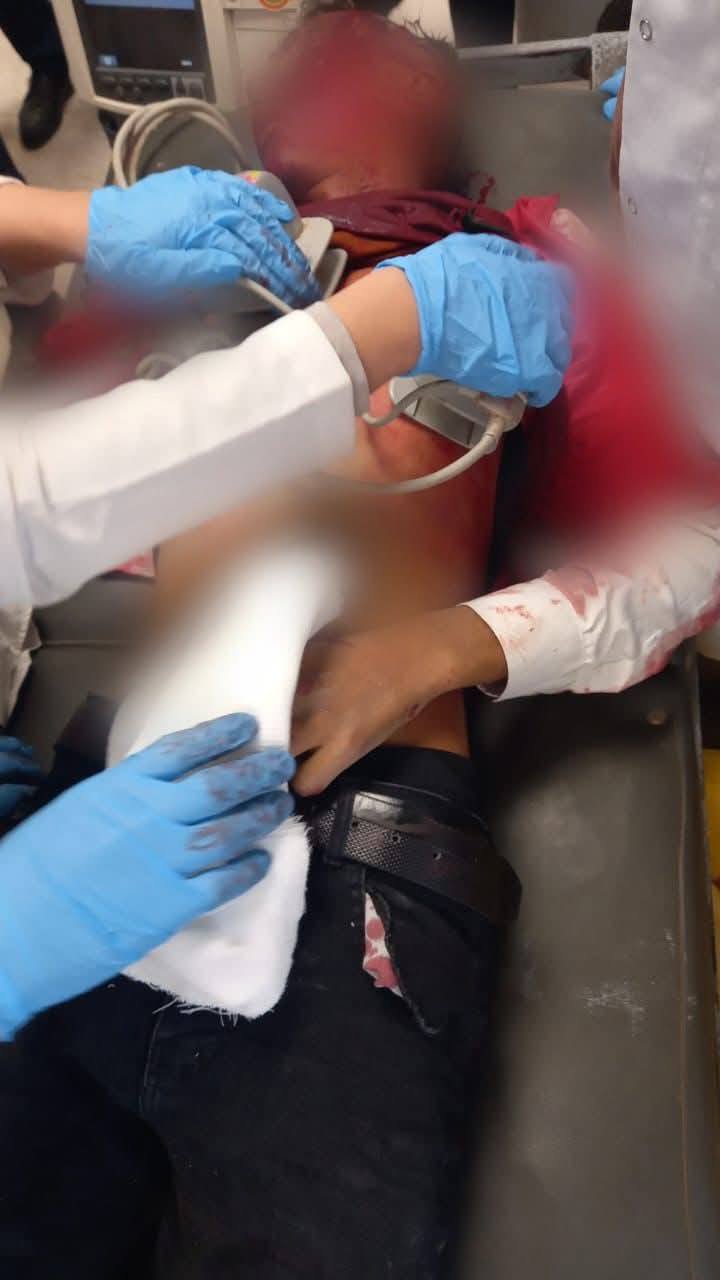 وفاة طفل وإصابة آخر بسقوط سقف صف في مدرسة القدّوس باليوسفية جنوبي بغداد