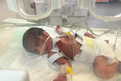 بسبب تداعيات الحرب.. ارتفاع أعداد تشوهات المواليد في غزة