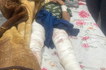 الصحة: الطفل الذي تعرض لهجوم نمر في حديقة حيوانات الزوراء على قيد الحياة وحالته مستقرة