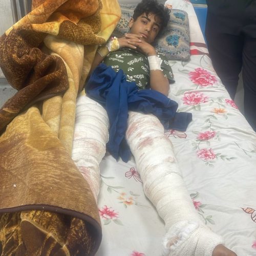 الصحة: الطفل الذي تعرض لهجوم نمر في حديقة حيوانات الزوراء على قيد الحياة وحالته مستقرة