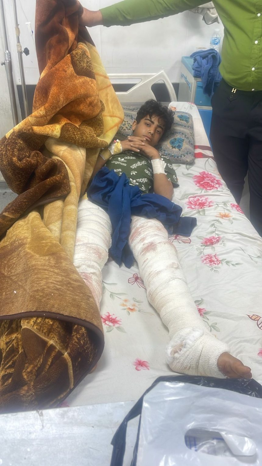 الصحة: الطفل الذي تعرض لهجوم نمر في حديقة حيوانات الزوراء على قيد الحياة وحالته مستقرة