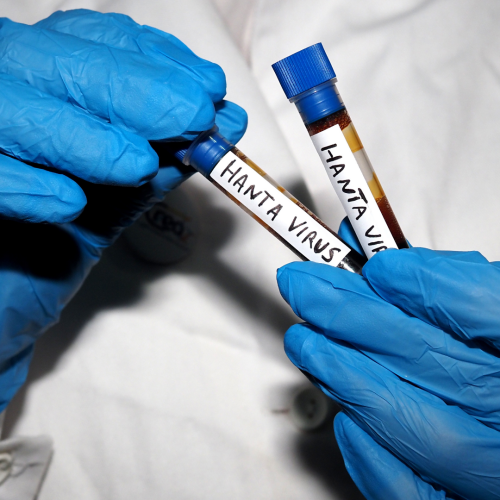 كندا تسجل أول حالة إصابة بفيروس هانتا