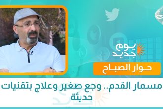 مسمار القدم.. وجع صغير وعلاج بتقنيات حديثة