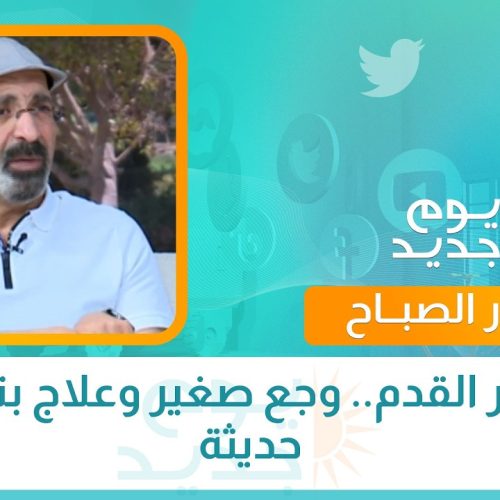 مسمار القدم.. وجع صغير وعلاج بتقنيات حديثة