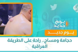 حجامة ومساج.. راحة على الطريقة العراقية